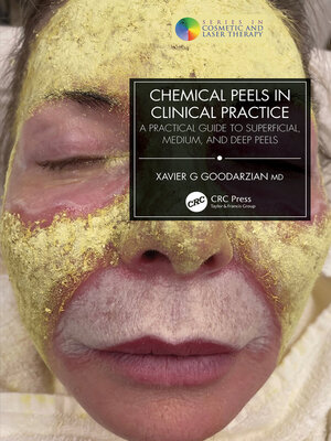 cover image of Chemical Peels in Clinical Practice